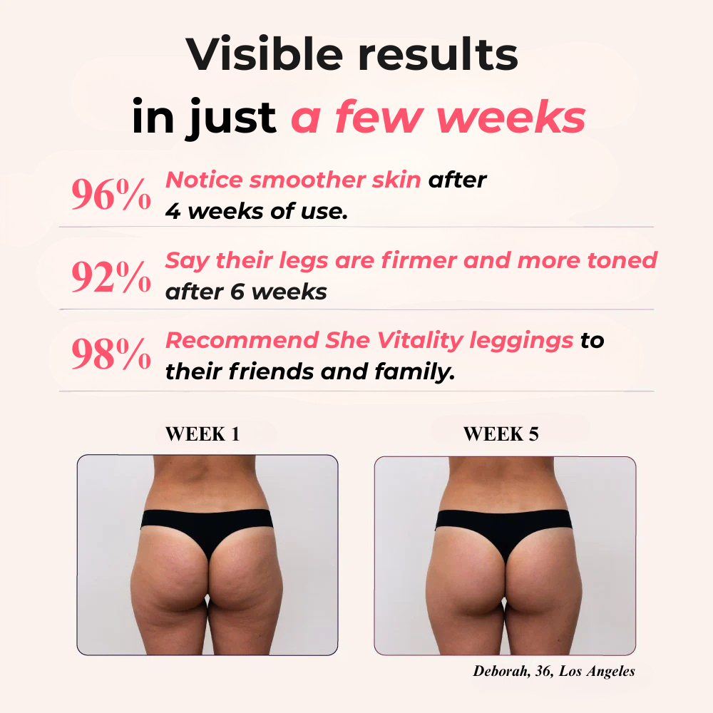 Leggings 3D Vitality