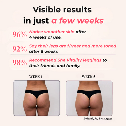 Leggings 3D Vitality